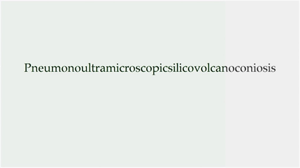 14. Supercalifragilisticexpialidocious'landıramadıklarımızdan mısınız?